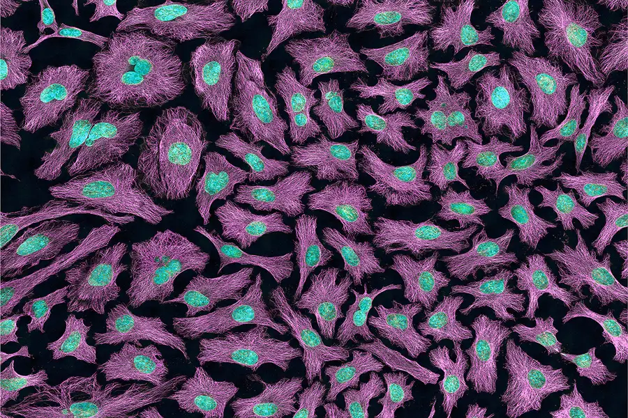 multiphotonfluorescenceimageofhelacellswithcytoskeletalmicrotubulesanddna.jpg