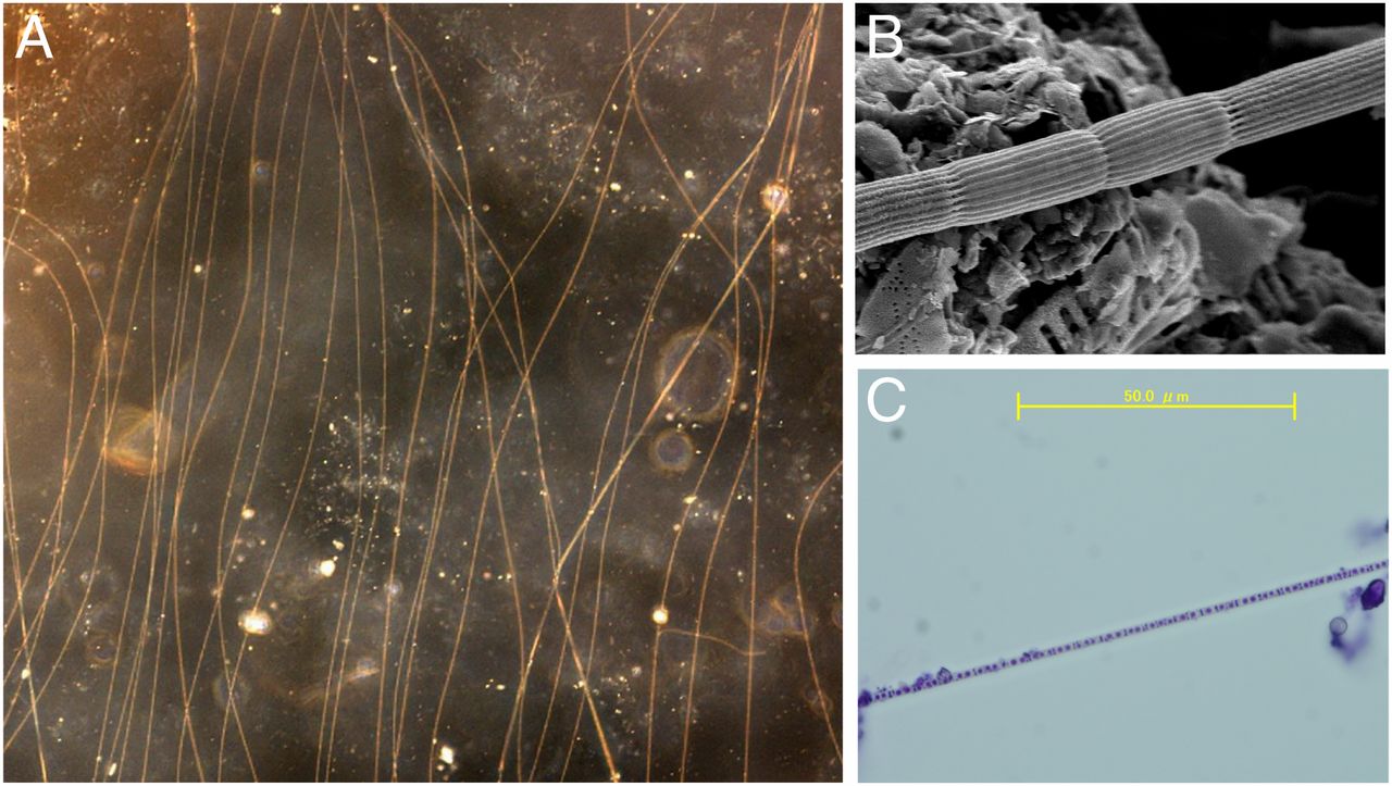 pollution-microscopicimagesofcablebacteria.jpeg