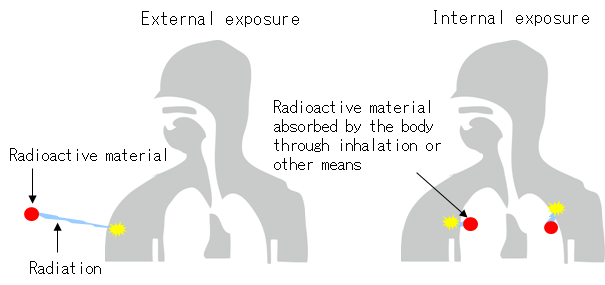 radiation-externalandinternalexposure.jpg